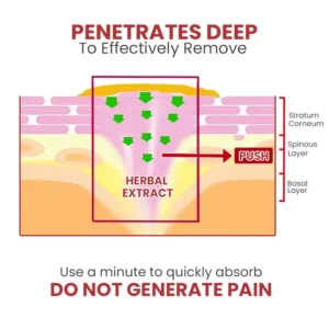 Alternative view of HOLO Medical Wart Removal Cream