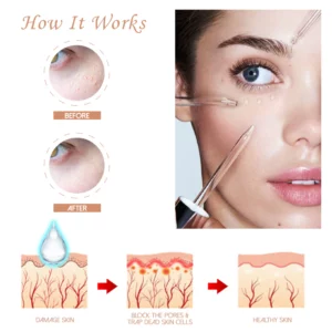 Alternative view of HerbPRO Milia FatGranules Reduce Serum