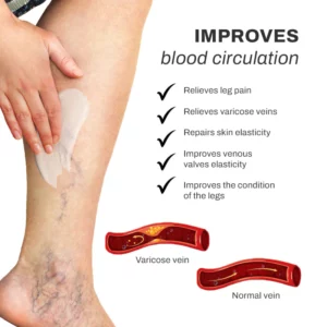 Alternative view of LymphCare VaricoseVeins Treatment Cream