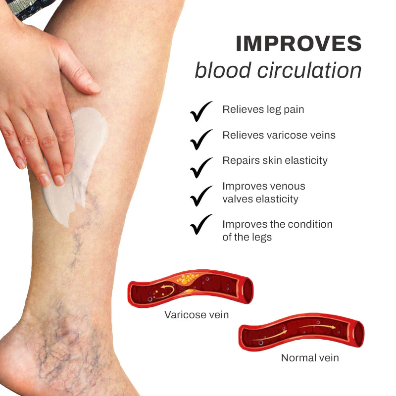 LymphCare VaricoseVeins Treatment Cream - Image 2