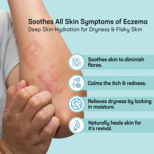 Alternative view of MEDix™ Eczema Treatment Spray