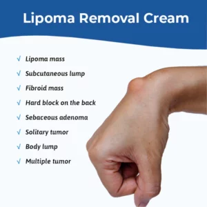 Alternative view of MEDix™ Lipoma Removal Cream
