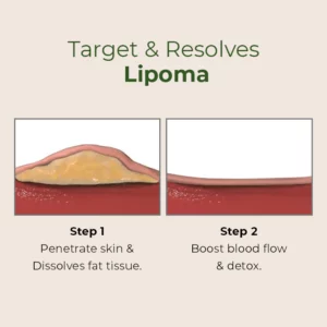 Alternative view of MEDix™ Lipoma Removal Patch