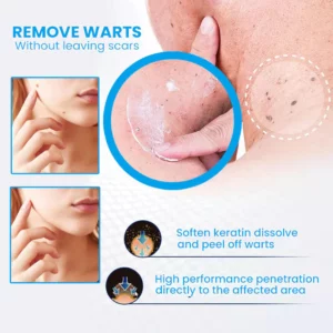 Alternative view of MaxPerformance WartClearPLUS Instant Wart Removal Ointment