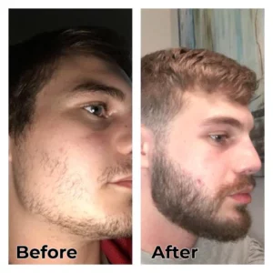 Alternative view of Mens Beard Hair Growth Spray