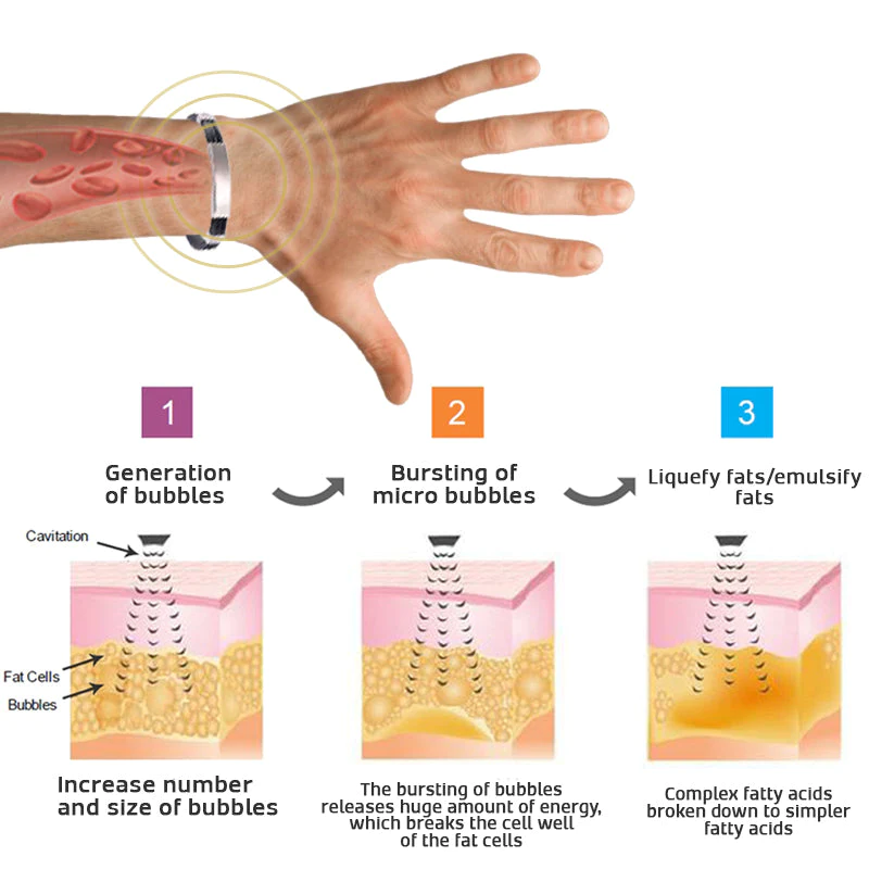 QTitanium Lymphatic Detox Wristband - Image 3
