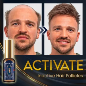 Alternative view of Revialite Hair Regrowth Serum