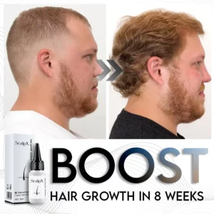 Alternative view of ScalpX Hair Growth Essence