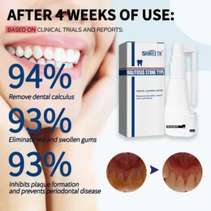 Alternative view of ShinTeeth® Calculus Dissolving Powerful Oral Spray
