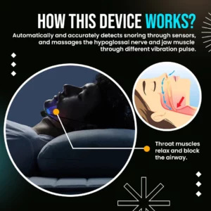 Alternative view of SleepPro™ Smart EMS Anti Snoring & Apnea Device