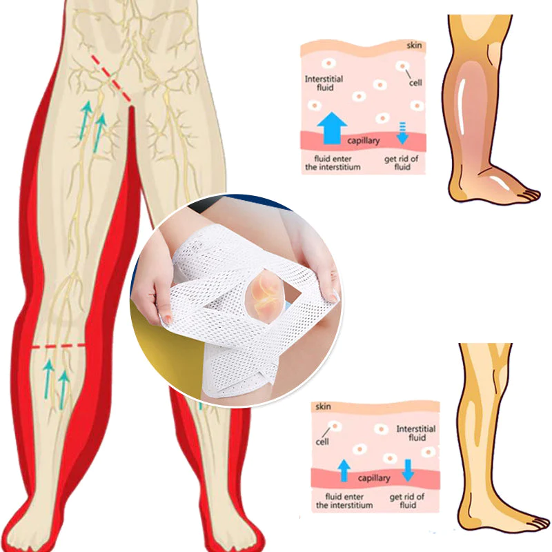 TrawDex™ AntiEdema Compression Strap - Image 4