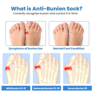 Alternative view of Wingle Anti-Bunions Health Sock