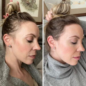 Alternative view of RapidGrow™ - Ginger Hair Growth Shampoo