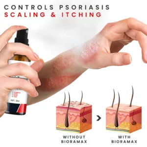 Alternative view of BIORAMAX PsoriaRescue Treatment Spray