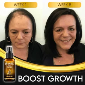 Alternative view of BioPRO Hair Growth Boosting Spray