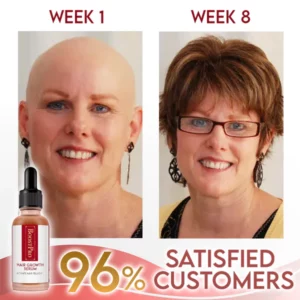 Alternative view of BoostPRO Hair Growing Serum