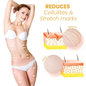 Alternative view of EssuraVita AntiCellulite Hip Lifting Body Oil