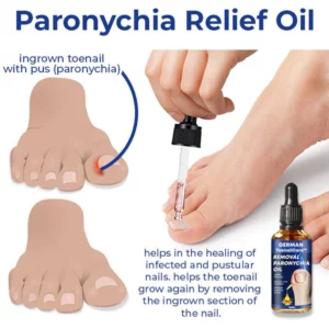 Alternative view of German ToenailCare™ Removal Paronychia Oil