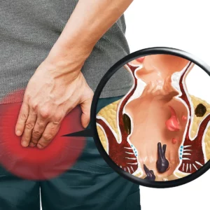 Alternative view of Herbal Hemorrhoids Calm Cream