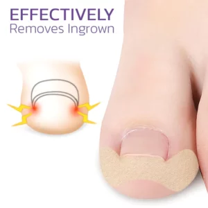 Alternative view of Japanese Elastic Toenail Correction Patch
