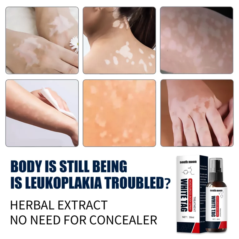 Spray para aliviar el vitiligo Kolmax™