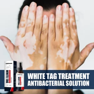 Kolmax™ Vitiligo Relief Spray