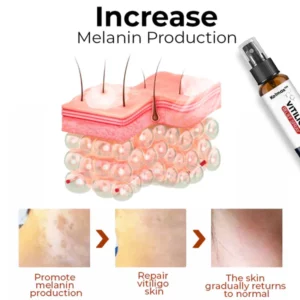 Alternative view of Kolmax™ Vitiligo Relief Spray