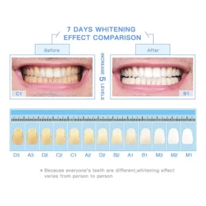 Alternative view of LAFEIGE NePLUS Teeth Whitening Tooth Essence