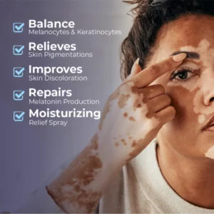 Alternative view of MEDix™ Vitiligo Relief Spray