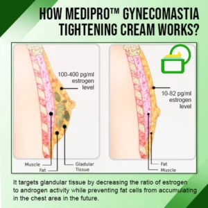 Alternative view of MediPRO™ Gynecomastia Tightening Cream