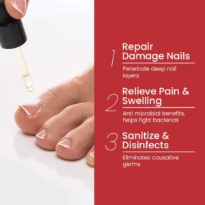 Alternative view of NailPro™ Anti Paronychia Relief Oil