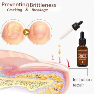 Alternative view of NailRelief AntiParonychia Herbal Oil