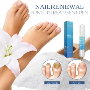 Alternative view of NailRenewal FungusTreatment Pen