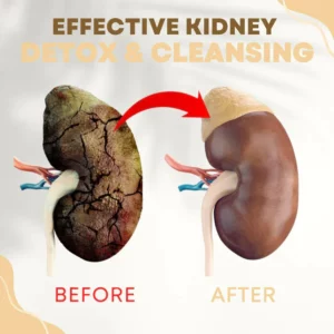 Alternative view of NatureCleanse™ Kidney Support Herbal Effervescent Tablets