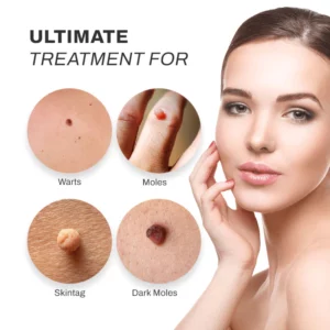 Alternative view of PUREOrganic WartRemover Cream