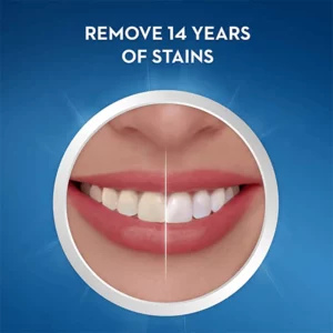 Alternative view of SMILEKIT® 5D Teeth Whitening Strips