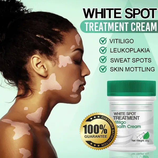 Krim Perawatan Bintik Putih SkinMedix™