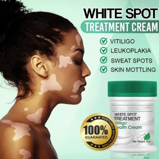 SkinMedix™ White Spot Treatment Cream