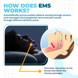 Alternative view of SleepPro™ EMS Anti-Snoring Device