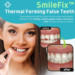 Alternative view of SmileFix™ Thermal Forming False Teeth