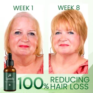 Alternative view of Speedy 7Days Hair Growing Serum