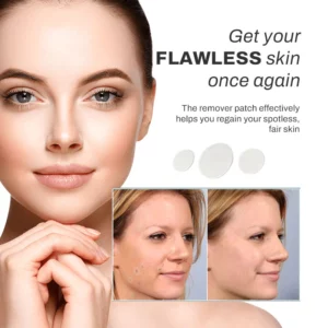 Alternative view of SpotOff SkinTag RemoverPatches