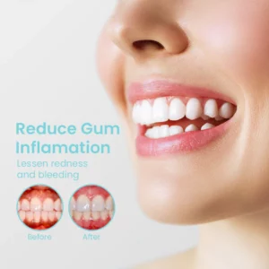 Alternative view of TotalCare™ Teeth Aid Mouthwash