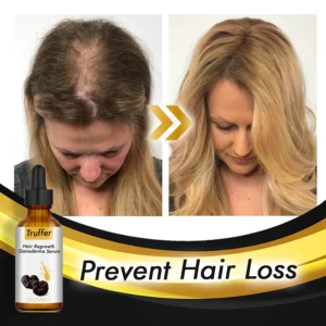 Alternative view of Truffer Hair Regrowth Ganoderma Serum