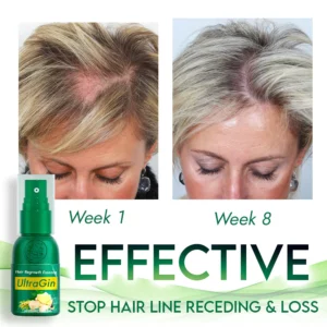 Alternative view of UltraGin Hair Regrowth Essence