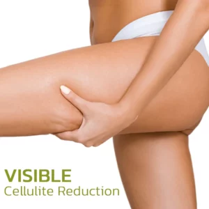 Alternative view of XHerbalLegs Cellulite Reduction Patches