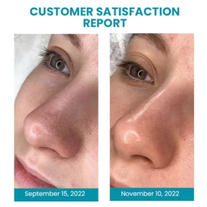 Alternative view of Anahita Japan Oligopeptide Pores Contraction Essence
