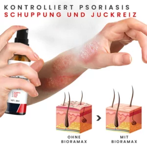 Alternative view of BIORAMAX PsoriaRescue Behandlung Spray