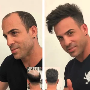 Alternative view of BioStrands Hair Regrowth Kit