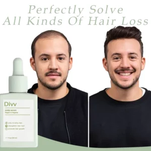 Alternative view of Divv™ Scalp Serum - Repair + Regrow Hair And Scalp